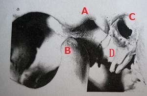 顎関節と耳の位置関係